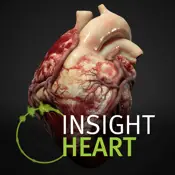 INSIGHT HEART - problemi, greške i kvarovi danas